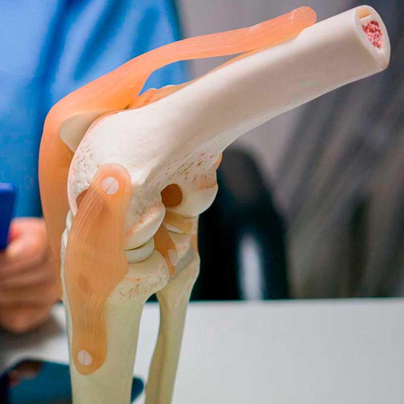 especialistas-en-prótesis-de-rodilla
