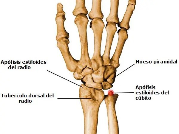 Fisioterapia para la Esitloidtis