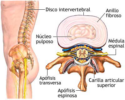 Qué es una hernia discal. Anatomía