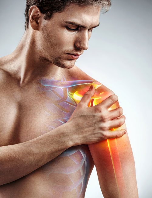 fisioterapia para la tendinitis del manguito rotador del hombro